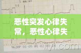 恶性突发心律失常,恶性心律失常诱因